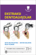 Ekstraksi dentoalveolar