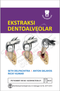 Ekstraksi dentoalveolar