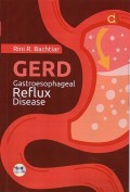 GERD gastroesophageal reflux disease