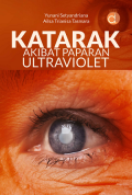 Katarak akibat paparan ultraviolet