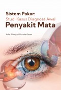 Sistem pakar : studi kasus diagnosa awal penyakit mata