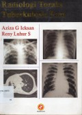 Radiologi Toraks Tuberkulasis Paru