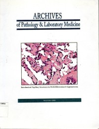 Archives of pathology & laboratory medicine : intraluminal papillaty structures in well-differentiated angiosarcoma
